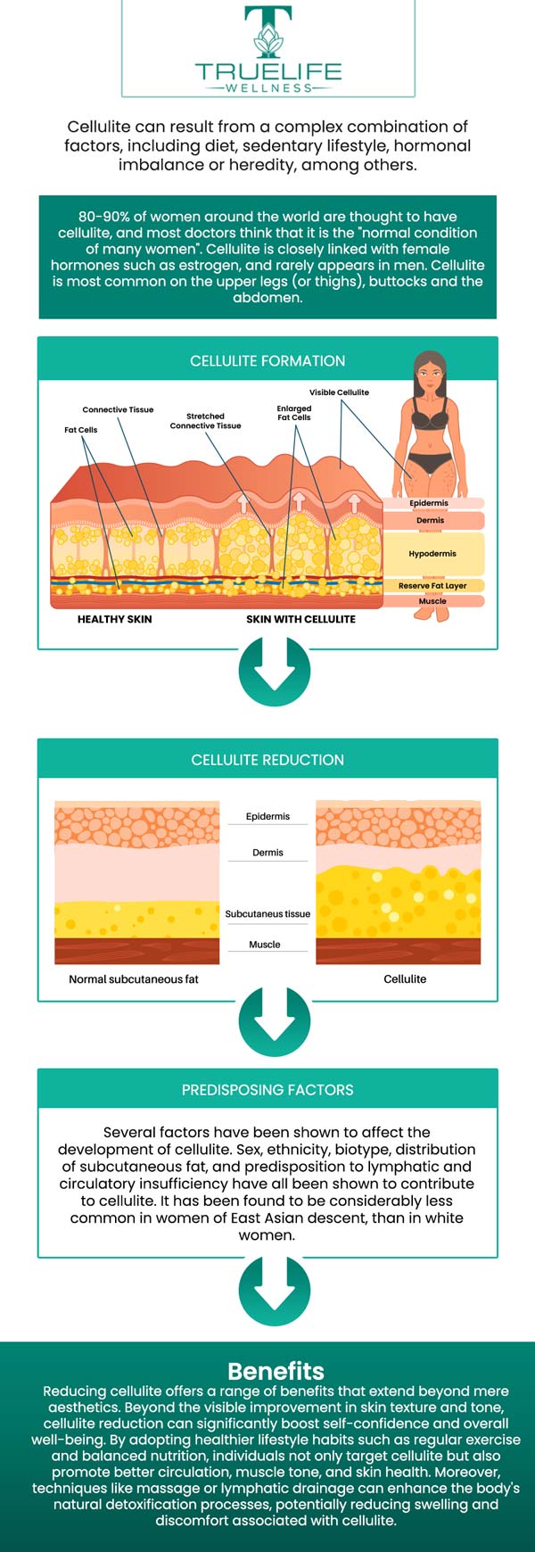 BTL cellutone represents a noninvasive solution for reducing cellulite and enhancing skin texture and firmness. BTL cellutone directly addresses the fundamental factors contributing to cellulite formation, resulting in a discernible enhancement in the overall tone and texture of the skin. This treatment utilizes vibrations to minimize the appearance of cellulite and tighten the skin on numerous regions of the body, including the thigh, abdomen, and buttocks. It improves the blood flow and lymphatic drainage of the treated areas and aids in the elimination of waste materials from the tissues. If you are embarrassed by your cellulite, Dr. Vinay Katukuri, MD, provides a non-invasive procedure to improve your body contouring needs at True Life Wellness. For more information, contact us or schedule an appointment online. We are conveniently located at 809 E Oak St Suite 201, Kissimmee, FL 34744. BTL cellutone represents a noninvasive solution for reducing cellulite and enhancing skin texture and firmness. BTL cellutone directly addresses the fundamental factors contributing to cellulite formation, resulting in a discernible enhancement in the overall tone and texture of the skin. This treatment utilizes vibrations to minimize the appearance of cellulite and tighten the skin on numerous regions of the body, including the thigh, abdomen, and buttocks. It improves the blood flow and lymphatic drainage of the treated areas and aids in the elimination of waste materials from the tissues. If you are embarrassed by your cellulite, Dr. Vinay Katukuri, MD, provides a non-invasive procedure to improve your body contouring needs at True Life Wellness. For more information, contact us or schedule an appointment online. We are conveniently located at 809 E Oak St Suite 201, Kissimmee, FL 34744.