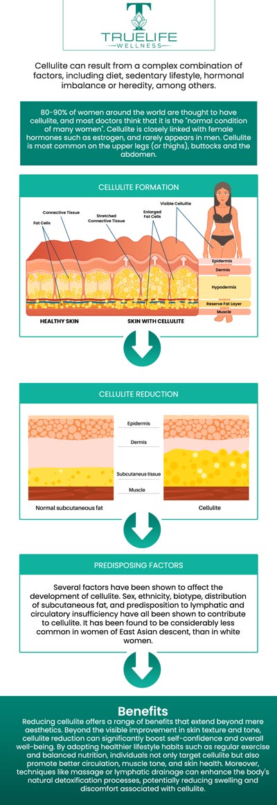 BTL cellutone represents a noninvasive solution for reducing cellulite and enhancing skin texture and firmness. BTL cellutone directly addresses the fundamental factors contributing to cellulite formation, resulting in a discernible enhancement in the overall tone and texture of the skin. This treatment utilizes vibrations to minimize the appearance of cellulite and tighten the skin on numerous regions of the body, including the thigh, abdomen, and buttocks. It improves the blood flow and lymphatic drainage of the treated areas and aids in the elimination of waste materials from the tissues. If you are embarrassed by your cellulite, Dr. Vinay Katukuri, MD, provides a non-invasive procedure to improve your body contouring needs at True Life Wellness. For more information, contact us or schedule an appointment online. We are conveniently located at 809 E Oak St Suite 201, Kissimmee, FL 34744. BTL cellutone represents a noninvasive solution for reducing cellulite and enhancing skin texture and firmness. BTL cellutone directly addresses the fundamental factors contributing to cellulite formation, resulting in a discernible enhancement in the overall tone and texture of the skin. This treatment utilizes vibrations to minimize the appearance of cellulite and tighten the skin on numerous regions of the body, including the thigh, abdomen, and buttocks. It improves the blood flow and lymphatic drainage of the treated areas and aids in the elimination of waste materials from the tissues. If you are embarrassed by your cellulite, Dr. Vinay Katukuri, MD, provides a non-invasive procedure to improve your body contouring needs at True Life Wellness. For more information, contact us or schedule an appointment online. We are conveniently located at 809 E Oak St Suite 201, Kissimmee, FL 34744.